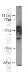 17375-1-AP - Vasculin-like protein 1