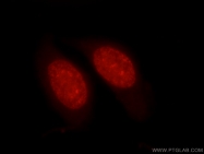 17510-1-AP - Histone H1.0