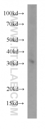 17510-1-AP - Histone H1.0