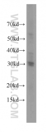17510-1-AP - Histone H1.0