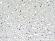 21228-1-AP - Brain link protein 2 / BRAL2