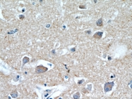 21228-1-AP - Brain link protein 2 / BRAL2