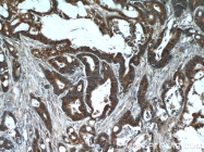 19358-1-AP - Host cell factor / HCFC1