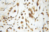 10197-1-AP - HDAC1