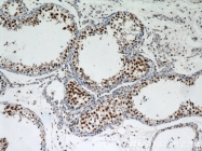 10197-1-AP - HDAC1