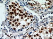 10197-1-AP - HDAC1