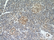 10197-1-AP - HDAC1