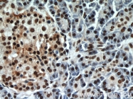 10197-1-AP - HDAC1