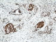 10197-1-AP - HDAC1