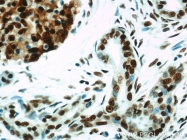 10197-1-AP - HDAC1