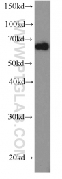 66085-1-Ig - HDAC1