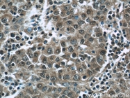 24913-1-AP - HDAC10