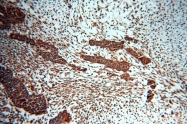 10255-1-AP - HDAC3