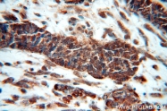 10255-1-AP - HDAC3