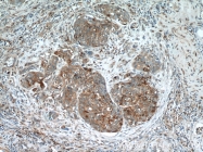17449-1-AP - HDAC4