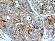 17449-1-AP - HDAC4
