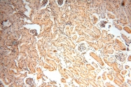 17449-1-AP - HDAC4