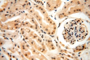 17449-1-AP - HDAC4