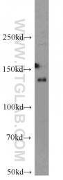 17449-1-AP - HDAC4