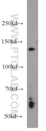 17449-1-AP - HDAC4