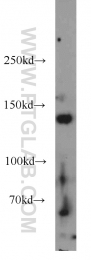 17449-1-AP - HDAC4