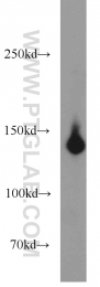 17449-1-AP - HDAC4