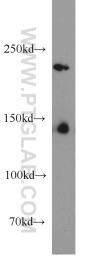 17449-1-AP - HDAC4