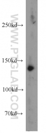 17449-1-AP - HDAC4