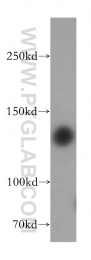 17449-1-AP - HDAC4