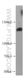 17449-1-AP - HDAC4