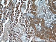 16165-1-AP - HDAC4