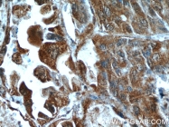 16165-1-AP - HDAC4