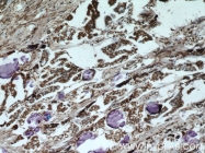 16165-1-AP - HDAC4