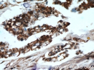 16165-1-AP - HDAC4