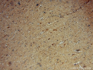 16166-1-AP - HDAC5