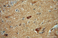 16166-1-AP - HDAC5
