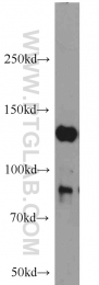 16166-1-AP - HDAC5