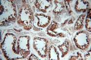12834-1-AP - HDAC6