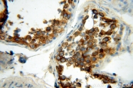 12834-1-AP - HDAC6