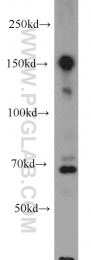 12834-1-AP - HDAC6