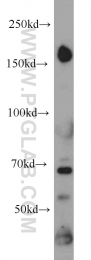 12834-1-AP - HDAC6