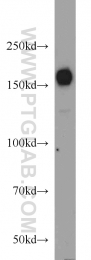 12834-1-AP - HDAC6