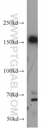 12834-1-AP - HDAC6