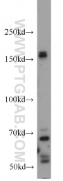 12834-1-AP - HDAC6