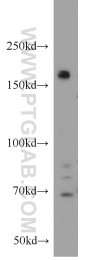 12834-1-AP - HDAC6