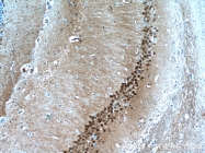 16167-1-AP - HDAC6