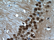 16167-1-AP - HDAC6