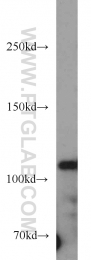 16167-1-AP - HDAC6