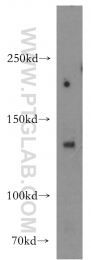 16167-1-AP - HDAC6