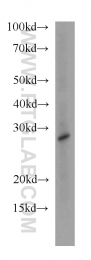 20821-1-AP - HDHD3